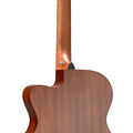 Back of Martin OMC-10E Guitar image number 2